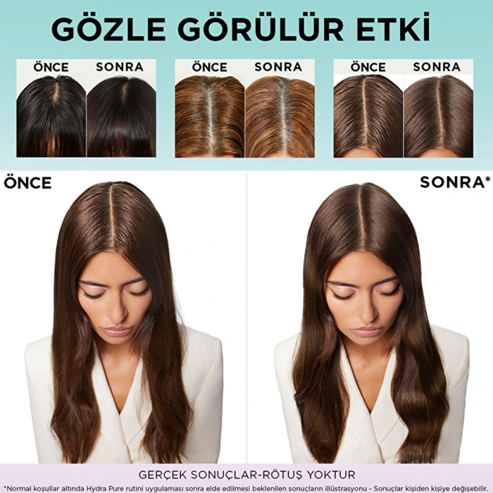 Loreal Paris Elseve Hydra Hyaluronic Pure Salisilik Asit İçeren Yağlanma Karşıtı Arındırıcı Şampuan 300 ml