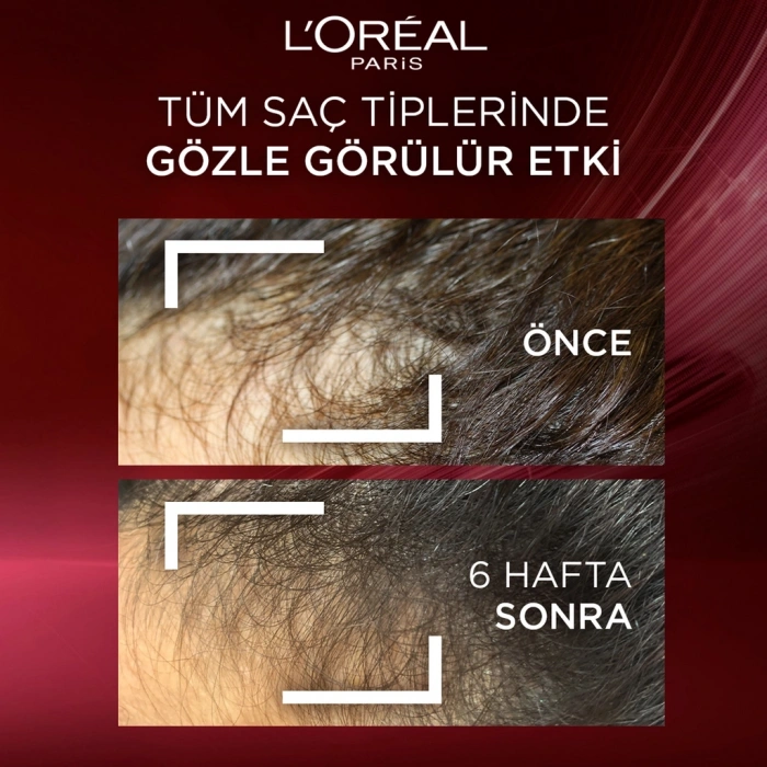 Loreal Paris Elseve Komple Direnç Dökülme Karşıtı Bakım Şampuanı 700 ml