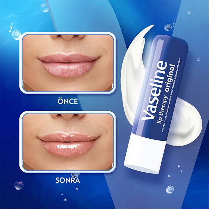 Vaseline Lip Therapy Dudak Bakım Kremi Original 4.8 gr