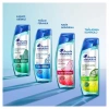 Head & Shoulders Derinlemesine Temiz Saç Derisi Detoksu Kepeğe Karşı Etkili Şampuan 300 ml
