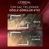 Loreal Paris Elseve Komple Direnç Dökülme Karşıtı Bakım Şampuanı 700 ml