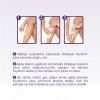 Sesu Ağda Bezi 10 Metre