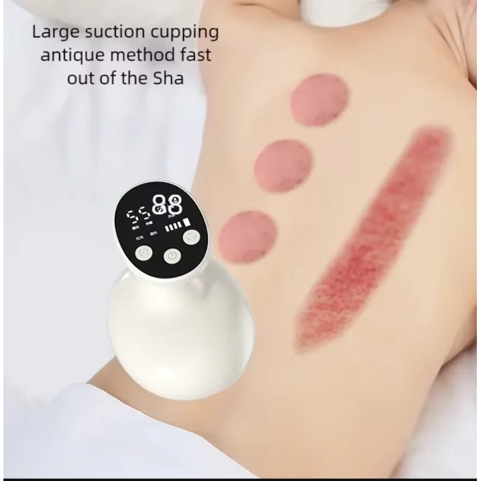 Timion Sıcaklık Emişli Bardak Çekme Terapisi, Vakumlu Masaj Aleti,Terapi Cihazı Masaj Cihazı (5148)