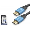 HDMI 2.0 Kablo 4K Uhd 19+1 Od 8.0 Mm 1.5Mt (Siyah Mavi,ND4050)