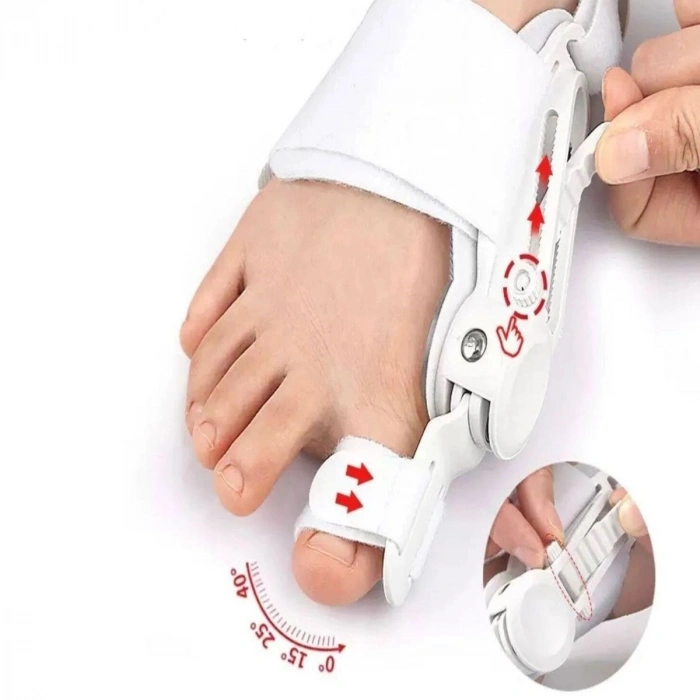 Ayarlanabilir Ayak Baş Parmak Kemik Düzeltici – Halluks Valgus (Bunyon) Aparatı, Gece Gündüz Kullanıma Uygun Ayak Düzeltme Ateli (5263)