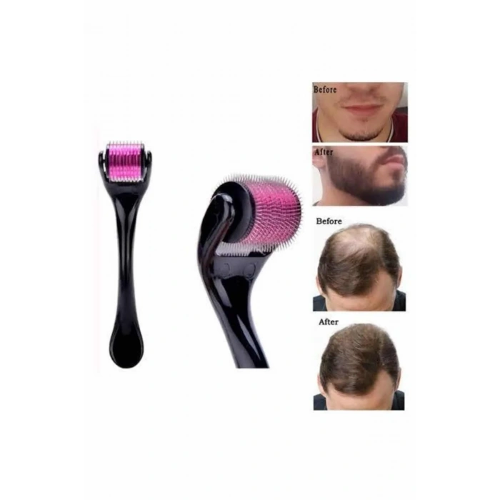 Saç Çıkarma Tarağı Dermaroller 540 Iğneli Roller 1 Mm Iğne Cilt Yüz Yenileme Bakım Seti