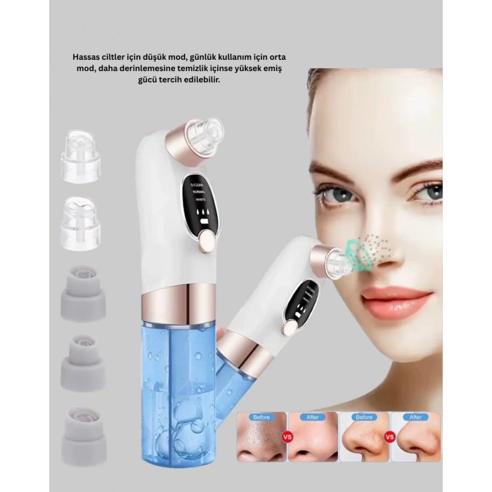 Vakum Teknolojili Siyah Nokta Temizleyici – Cilt Tonu Eşitleyen Masajlı Cilt Bakım Cihazı