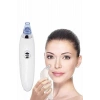 4 Başlıklı Pilli Vakumlu Siyah Nokta Temizleyici Akne Ve Sivilce Önleyici