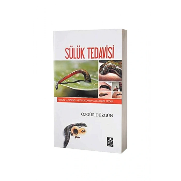 Sülük Tedavisi