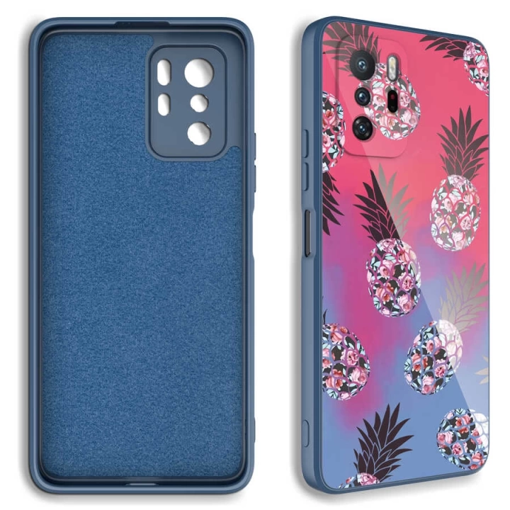 Xiaomi Redmi Note 10 Pro Kılıf Kamera Korumalı Desenli Sert Silikon Redclick Epoksi Kapak