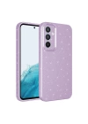 Galaxy A55 Kılıf Kamera Korumalı Simli Lüks Redclick Koton Kapak