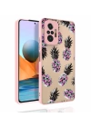 Xiaomi Redmi Note 10 Pro Kılıf Desenli Kamera Korumalı Parlak Redclick Nora Kapak