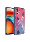 Xiaomi Redmi Note 10 Pro Kılıf Kamera Korumalı Desenli Sert Silikon Redclick Epoksi Kapak