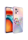 Xiaomi Redmi Note 10 Pro Kılıf Kamera Korumalı Desenli Sert Silikon Redclick Epoksi Kapak