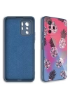Xiaomi Redmi Note 10 Pro Kılıf Kamera Korumalı Desenli Sert Silikon Redclick Epoksi Kapak