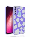 Xiaomi Redmi Note 8 Kılıf Desenli Kamera Korumalı Parlak Redclick Nora Kapak